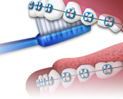 Brushing - Step 5