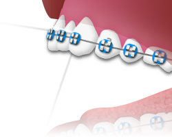 Flossing - Step 3